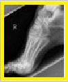 louisville orthopedics, ankle injuries