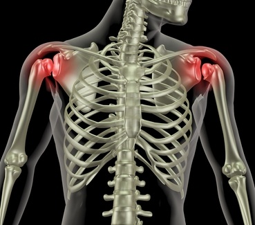 Shoulder Pain, Shoulder Injury, and Shoulder Impingement