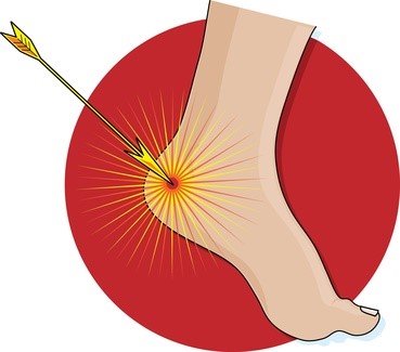 Heel Pain Causes | Plantar Fasciitis | Louisville Orthopedic