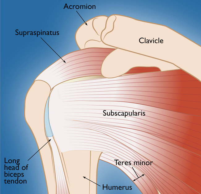 rotator-cuff-tear-louisville-bones