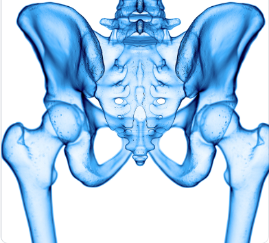 Hip Fractures Due to Osteosarcopenia