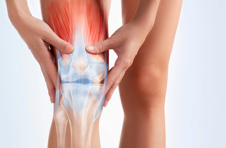 Arthritis and Knee Pain Diagram