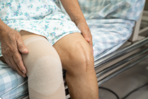 Knee Replacements Recovery