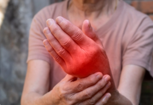 Types of Hand Arthritis Inflammation