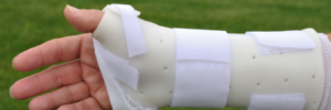 Buckle Fracture in Arm