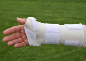 Buckle Fracture in Arm