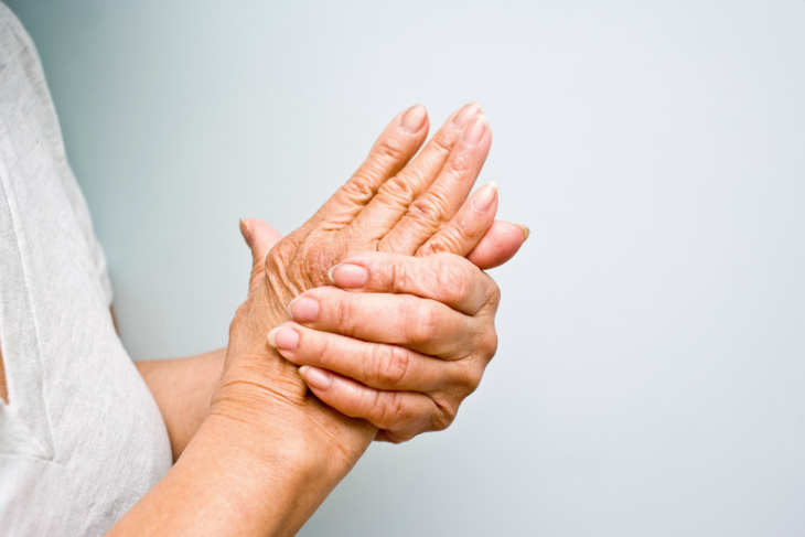 Arthritic Flare-Up Triggers and Symptoms