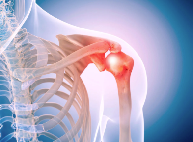 Labral Tear Shoulder Joint