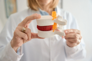 Disc herniation Model
