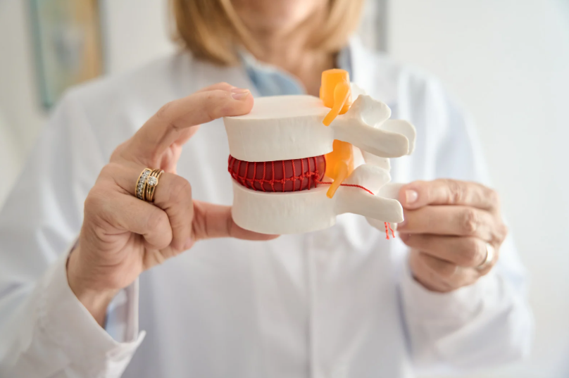 Disc herniation Model