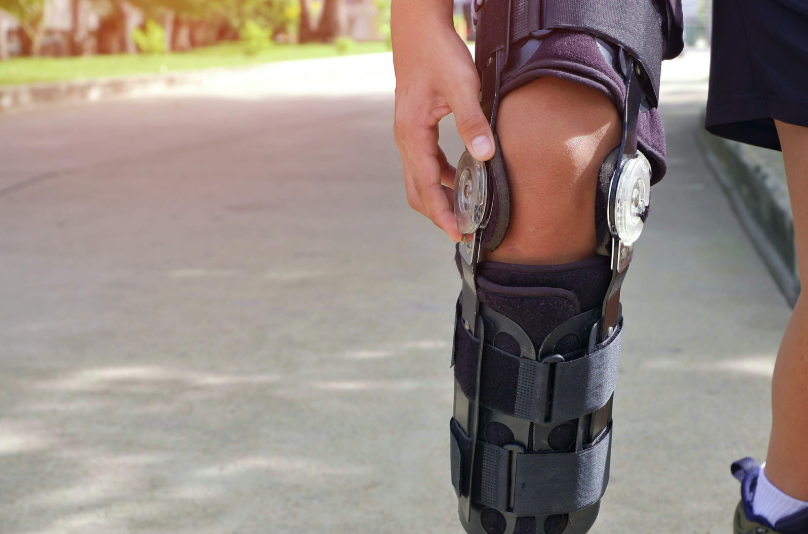 Severe Arthritis of the knee Unloader Knee Brace