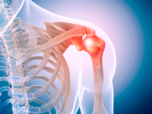 Shoulder Labrum Tears and the Mayo Shear Test