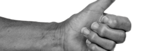Carpometacarpal Arthritis of the Thumb