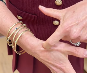 Anatomical Snuffbox location from Dr. Stacie Grossfeld